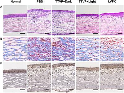 Efficient antibacterial AIEgens induced ROS for selective photodynamic treatment of bacterial keratitis